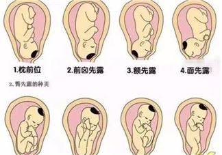 孕晚期宫缩频繁怎么办 如何缓解孕晚期宫缩肚子痛