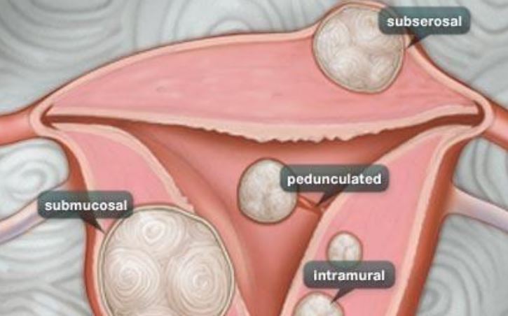 母乳妈妈喂奶得荨麻疹怎么办 母乳吗吗怎么改善荨麻疹