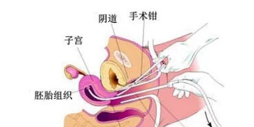 短效避孕药有副作用吗 哪些人不适合吃短效避孕药