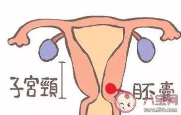 子宫角怀孕怎么回事 子宫角怀孕危险吗