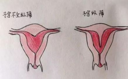 吃什么水果能解酒 喝酒后哪些水果不能吃