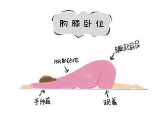 怀孕得了生殖器疱疹怎么办 孕妇得了生殖器疱疹可以顺产吗