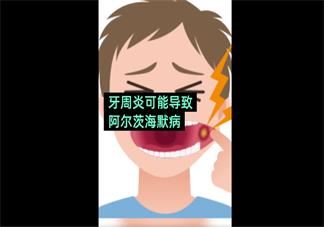 早上口腔发苦是怎么回事  怎么正确护理口腔