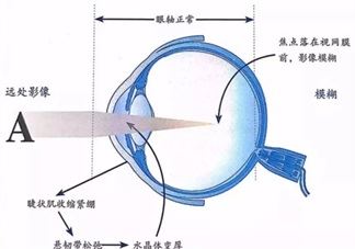 哪些行为习惯会造成宝宝磨牙 睡眠姿势会造成孩子磨牙吗