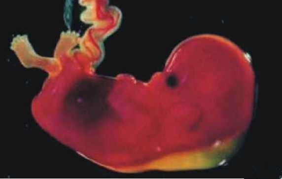 孕期尿频代表宝宝发育越好吗 孕期憋尿会怎么样