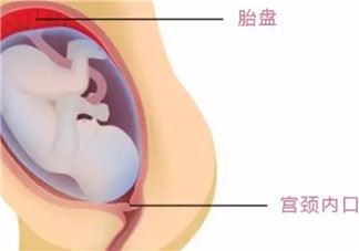 孕妇记忆力下降怎么办 孕妇怀孕后记忆力下降的原因