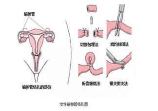 小雪到了发什么朋友圈好 今日小雪心情感言2024