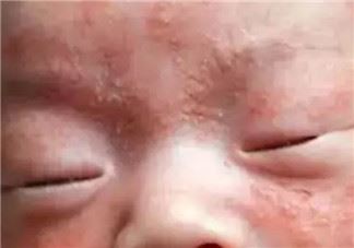 孩子冬天很容易生病怎么办 怎么让孩子冬天预防感冒
