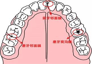 为什么儿童乳牙迟迟不脱落 儿童乳牙不脱落的原因