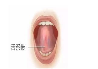 宝宝舌系带短有哪些影响 什么情况下宝宝的舌系带不能剪