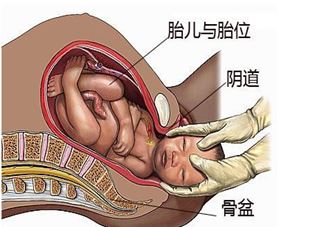 假性宫缩和早产征兆有什么区别 假性宫缩和早产征兆区别