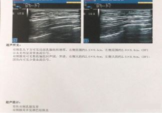 最好的抗衰老的方法是什么 抗衰老的方法技巧