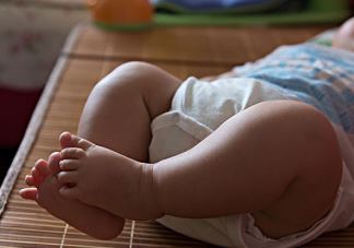 婴儿间擦疹怎么护理 夏天宝宝间擦疹要注意什么