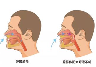 孩子病后总是反复是为什么 孩子病后总是反复怎么办