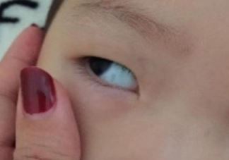 夏天给宝宝剃光头有什么危害 如何给孩子剪一个既凉快又安全的发型