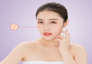 为什么卵巢癌被称为妇癌之王 卵巢癌会反复复发吗