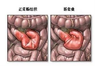 孩子病了有哪些症状 怎么一眼看出孩子生病了