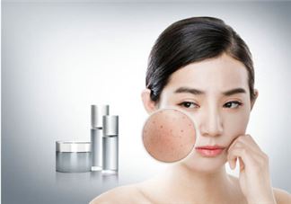 经前暗疮吃什么好 经前暗疮怎么调理