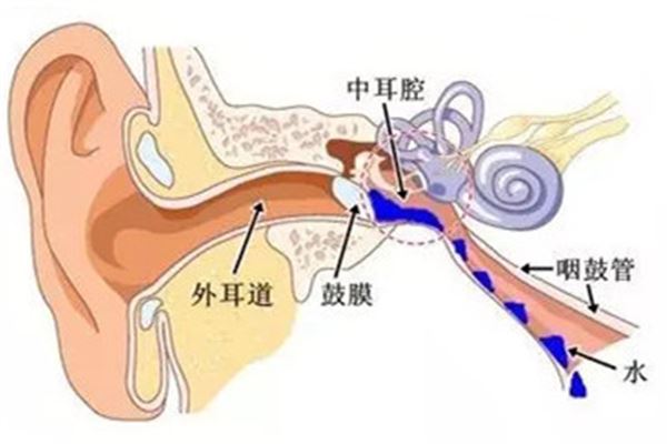 中耳炎症状表现有哪些 中耳炎是耳膜破了吗