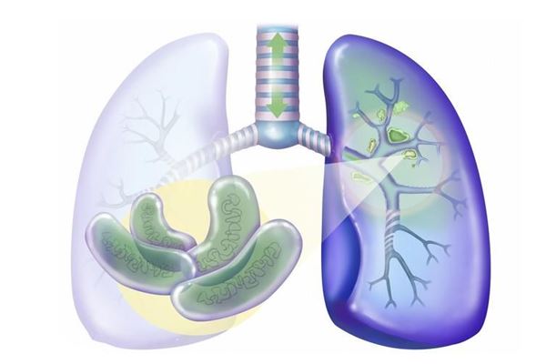 肺结核有潜伏期吗 肺结核有没有疫苗