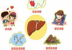 肝炎会传染吗？肝炎会不会传染别人？