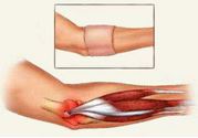 网球肘怎么治最好?网球肘的中医治疗方法