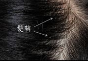 头发上有管状附着物怎么去除 发鞘是什么