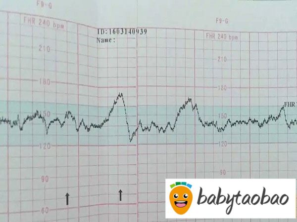男女宝宝胎心率对照表分享，大于150一定是女孩待商榷