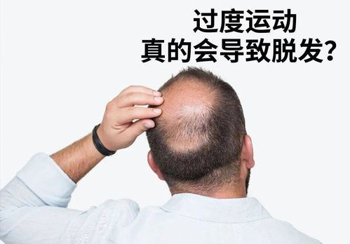 减肥会引起脱发吗？揭秘减肥与头发关系的真相！