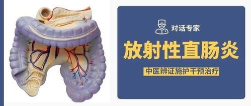 放射性直肠炎（症状治疗及预防措施）