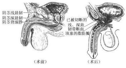 如何增大阴径？有效方法大揭秘