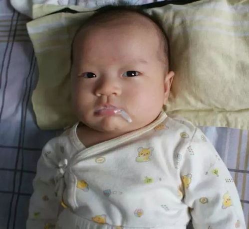 婴儿鼻子呛奶怎么办？有效的解决方法分享