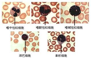 白细胞低引起的原因及治疗方法详解