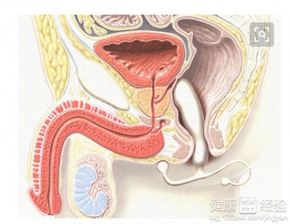 前列腺炎的症状及治疗方法详解
