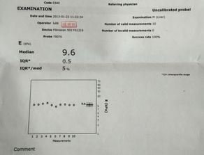 乙肝窗口期是什么？如何识别和预防？