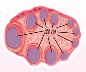 多囊性卵巢综合症的症状治疗及预防措施