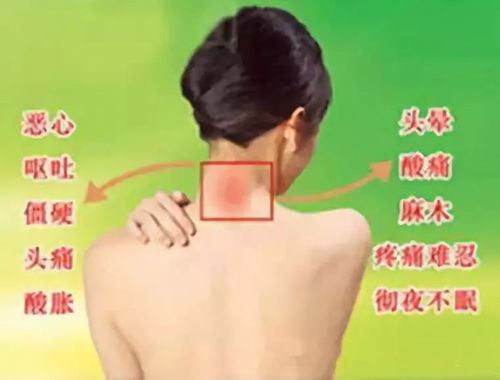 颈椎引起的头晕目眩（如何缓解颈椎病引发的不适症状）