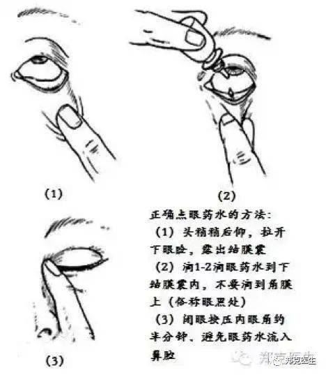 散瞳对眼睛的危害有多大，如何正确使用散瞳眼药水