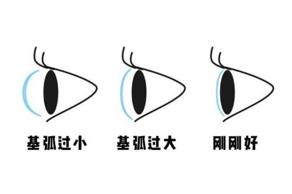 隐形眼镜基弧大好还是小好 一般是宁大勿小