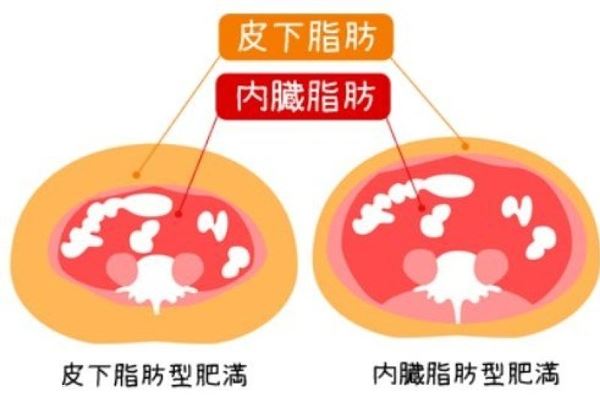 内脏脂肪和皮下脂肪的区别 内脏脂肪怎么减肥