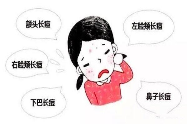 脸上刚挤完痘怎么办 脸上刚挤完痘要注意什么