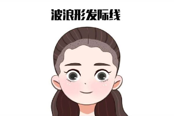 发际线后移怎么恢复 发际线后移是什么原因引起的