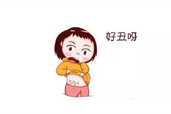 妊娠纹会越来越多吗 妊娠纹怎么修复快