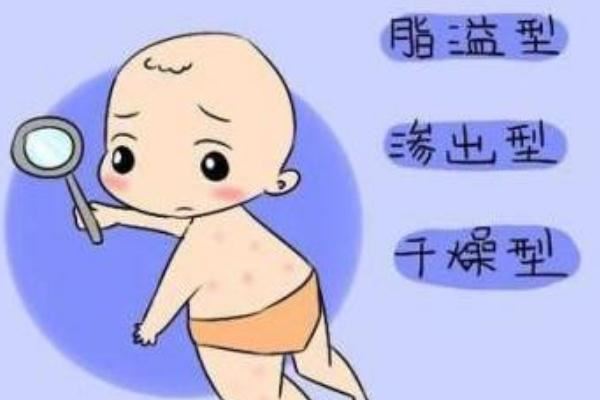 新生儿湿疹怎么治疗最好的方法 新生儿湿疹是什么引起的