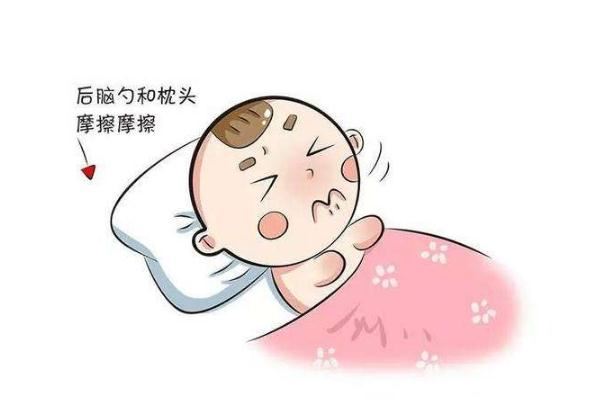婴儿枕秃是怎么回事 婴儿枕秃的症状