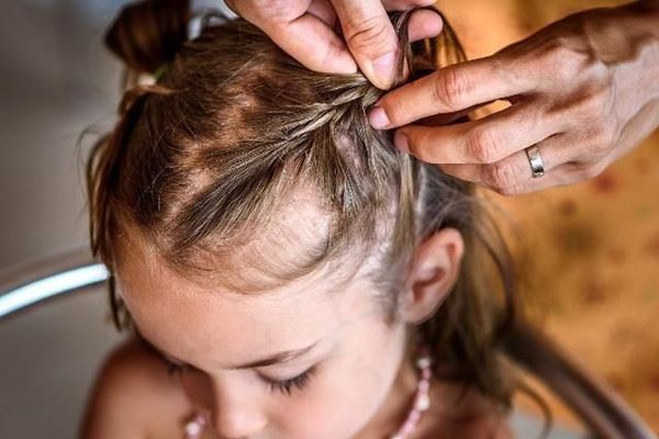 孩子头发稀少怎么办 孩子头发少是什么原因