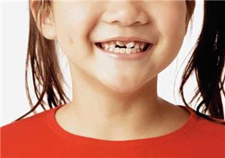 儿童换牙可以吃钙片吗?儿童换牙吃什么好？