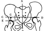 骨盆多大适合顺产骨盆大小怎样测量