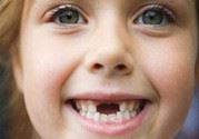 小孩换牙半年还没长出来是怎么回事?小孩换牙注意事项